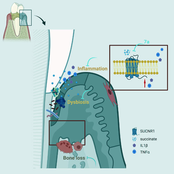 Guo et al. reveal succinate’s effect on periodontitis pathogenesis and provides a topical treatment for this disease. Image credit: Guo et al., doi: 10.1016/j.celrep.2022.111389.