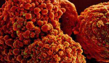 Colorized scanning electron micrograph of a cell infected with the Omicron strain of SARS-CoV-2 virus particles (yellow and green), isolated from a patient sample. Image credit: NIAID.