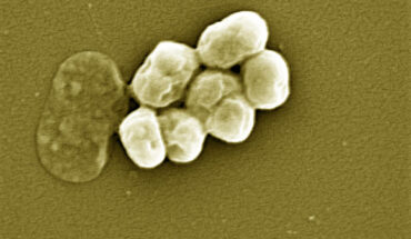 Morgan et al. established the activity spectrum of nourseothricin and its main components, streptothricin F (S-F, 1 lysine) and streptothricin D (S-D, 3 lysines), purified to homogeneity, against highly drug-resistant, carbapenem-resistant Enterobacterales and Acinetobacter baumannii (shown here). Image credit: Vader1941 / CC BY-SA 4.0.