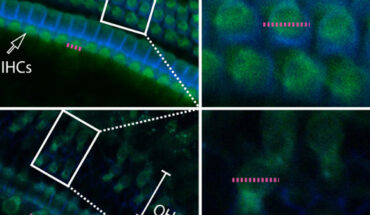 Representative confocal images of whole mounts organ of Corti from the medial region of the cochlea stained for filipin to label cholesterol (green) and phalloidin for visualizing actin in stereocilia (blue) from young (top) and old (bottom) C57BL/J mice. Scale bar - 30 μm. Rectangles indicate the region of the zoomed-in areas shown on the right using a 63x objective. Scale bar - 8 μm. Pink dotted lines represent the diameter of individual inner hair cells and outer hair cells. Image credit: Sodero et al., doi: 10.1371/journal.pbio.3002257.