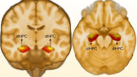 Orexigenic appetitive processing relies on the integration of sensory, interoceptive and hormonal signals to govern consummatory behaviors. Dysregulation of this process leads to maladaptive eating behavior such as binge eating and is associated with obesity. This circuit, however, was elusive in humans --- until now. Image credit: Barbosa et al., doi: 10.1038/s41586-023-06459-w.