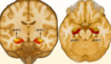 Orexigenic appetitive processing relies on the integration of sensory, interoceptive and hormonal signals to govern consummatory behaviors. Dysregulation of this process leads to maladaptive eating behavior such as binge eating and is associated with obesity. This circuit, however, was elusive in humans --- until now. Image credit: Barbosa et al., doi: 10.1038/s41586-023-06459-w.