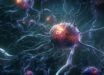 White matter degenerating microglia are a novel therapeutic target to potentially reduce the impact of white matter injury and myelin loss on the progression of cognitive impairment. Image credit: Miroslaw Miras.