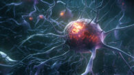 White matter degenerating microglia are a novel therapeutic target to potentially reduce the impact of white matter injury and myelin loss on the progression of cognitive impairment. Image credit: Miroslaw Miras.