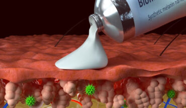 The synthetic melanin is being applied to inflamed skin; just under the surface of the skin are green free radicals, also known as reactive oxygen species (ROS). Image credit: Yu Chen, Northwestern University.