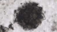 A microfossil from the 2.4-billion-year-old Turee Creek Group in Western Australia. Image credit: Barlow et al., doi: 10.1111/gbi.12576.