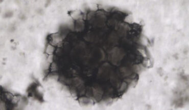 A microfossil from the 2.4-billion-year-old Turee Creek Group in Western Australia. Image credit: Barlow et al., doi: 10.1111/gbi.12576.