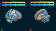Mendieta et al. used fMRI to measure brain activity in fans of rival soccer teams during match play. This image shows the contrast of winning and losing in the ‘good fanatic brain.’ It shows in warm colors the activity related to a significant victory. The blue scale represents the activation related to a significant loss; this pattern is congruent with the Mentalization Network, which suggests a rationalization process of the pain evoked by the losing scenario. Image credit: Mendieta et al.