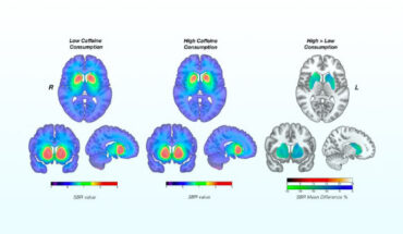 Chronic caffeine intake prompts compensatory and cumulative dopamine transporter downregulation, consistent with caffeine’s reported risk reduction in Parkinson’s disease. Image credit: Clinical Neurosciences, University of Turku.