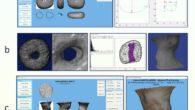 3D analysis of the perforated pebbles and the perforations. Image credit: T. Yashuv & L. Grosman, doi: 10.1371/journal.pone.0312007.