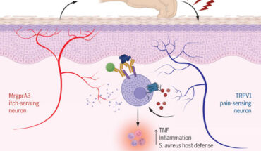 Scratching synergizes with FcεRI mast cell activation to drive allergic skin inflammation. Image credit: Liu et al., doi: 10.1126/science.adn9390.