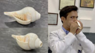 Upper airway muscle training by blowing shankh improves subjective measurements of daytime sleepiness and sleep quality with improvement in objective measures of severity of obstructive sleep apnea. Image credit: Sharma et al., doi: 10.1183/23120541.00258-2025.