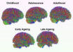 Mousley et al. compared the brains of 3,802 people between zero and ninety years old using datasets of MRI diffusion scans, which map neural connections by tracking how water molecules move through brain tissue. Image credit: Mousley et al., doi: 10.1038/s41467-025-65974-8.