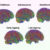 Mousley et al. compared the brains of 3,802 people between zero and ninety years old using datasets of MRI diffusion scans, which map neural connections by tracking how water molecules move through brain tissue. Image credit: Mousley et al., doi: 10.1038/s41467-025-65974-8.