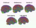 Mousley et al. compared the brains of 3,802 people between zero and ninety years old using datasets of MRI diffusion scans, which map neural connections by tracking how water molecules move through brain tissue. Image credit: Mousley et al., doi: 10.1038/s41467-025-65974-8.