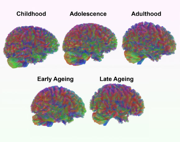 Mousley et al. compared the brains of 3,802 people between zero and ninety years old using datasets of MRI diffusion scans, which map neural connections by tracking how water molecules move through brain tissue. Image credit: Mousley et al., doi: 10.1038/s41467-025-65974-8.