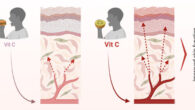 Vitamin C (ascorbate) is found in all skin compartments. Pullar et al. carried out a comprehensive investigation to establish the relationship between plasma and skin ascorbate levels, with a focus on the major skin compartments. Image credit: Pullar et al., doi: 10.1016/j.jid.2025.10.587.
