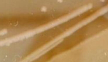 Isolated colonies of Psychrobacter SC65A.3 on R2A medium at 4 degrees Celsius (A) and on TSA medium at 15 degrees Celsius (B). Image credit: Ioana Paun et al., doi: 10.3389/fmicb.2025.1713017.