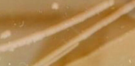 Isolated colonies of Psychrobacter SC65A.3 on R2A medium at 4 degrees Celsius (A) and on TSA medium at 15 degrees Celsius (B). Image credit: Ioana Paun et al., doi: 10.3389/fmicb.2025.1713017.