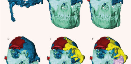Reconstruction of the face of StW 573. Image credit: A. Beaudet.