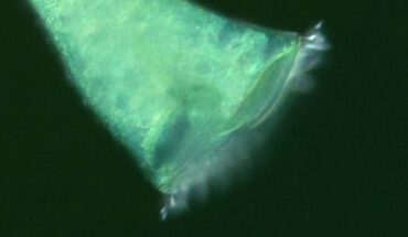 Stentor coeruleus. Image credit: Laboratory of Physical Ethology, Hokkaido University.