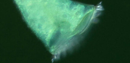 Stentor coeruleus. Image credit: Laboratory of Physical Ethology, Hokkaido University.