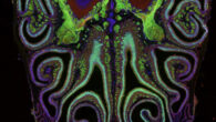 A cross section of a mouse nose. Image credit: Datta Lab, Harvard Medical School.