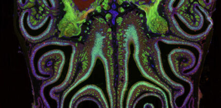 A cross section of a mouse nose. Image credit: Datta Lab, Harvard Medical School.