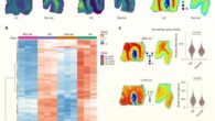 Spatial multiomics analysis reveals hyperglycosylation in human Alzheimer’s brains. Image credit: Hawkinson et al., doi: 10.1038/s42255-026-01538-4.
