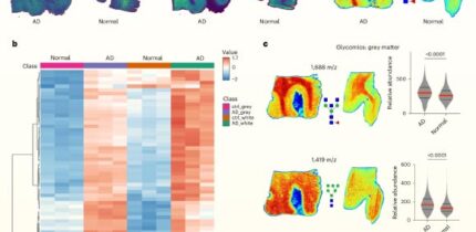 Spatial multiomics analysis reveals hyperglycosylation in human Alzheimer’s brains. Image credit: Hawkinson et al., doi: 10.1038/s42255-026-01538-4.