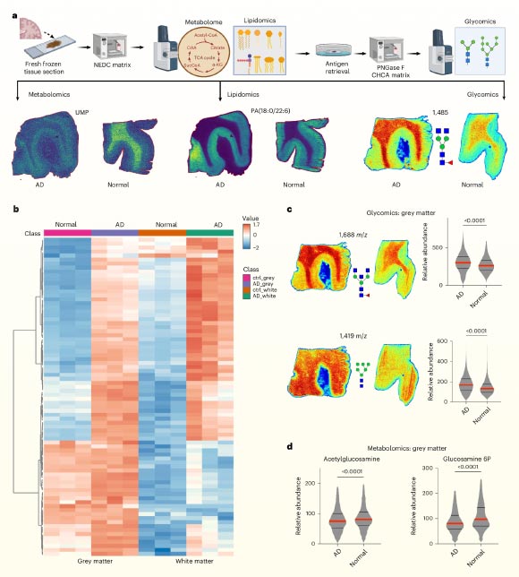 Spatial multiomics analysis reveals hyperglycosylation in human Alzheimer’s brains. Image credit: Hawkinson et al., doi: 10.1038/s42255-026-01538-4.