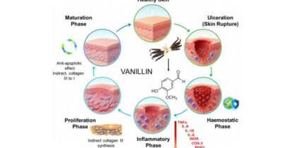Vanillin has pronounced antioxidant, anti-inflammatory and antibacterial properties. Image credit: Stoilov et al., doi: 10.1016/j.ijpharm.2026.127263.